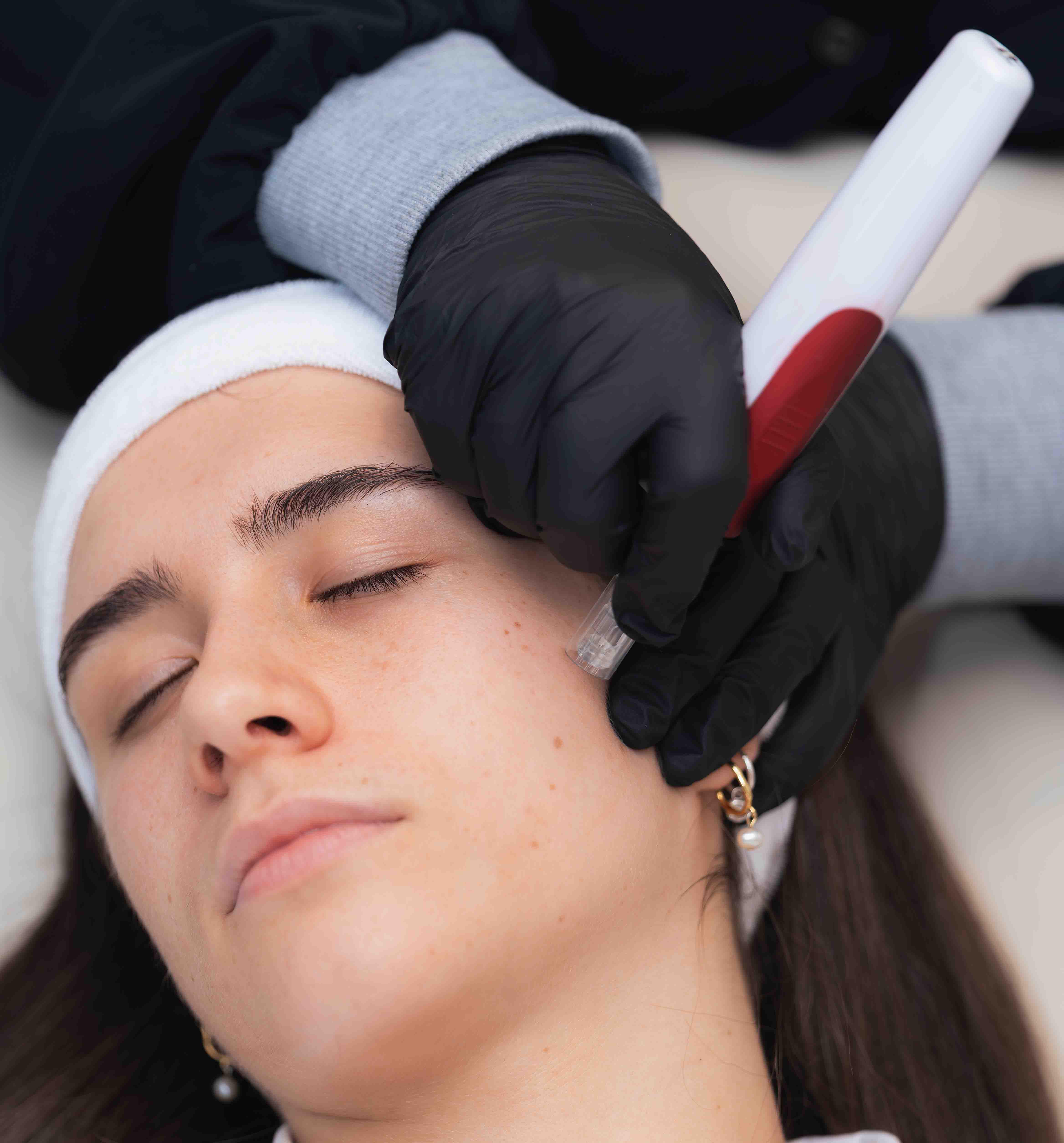 Dermapen