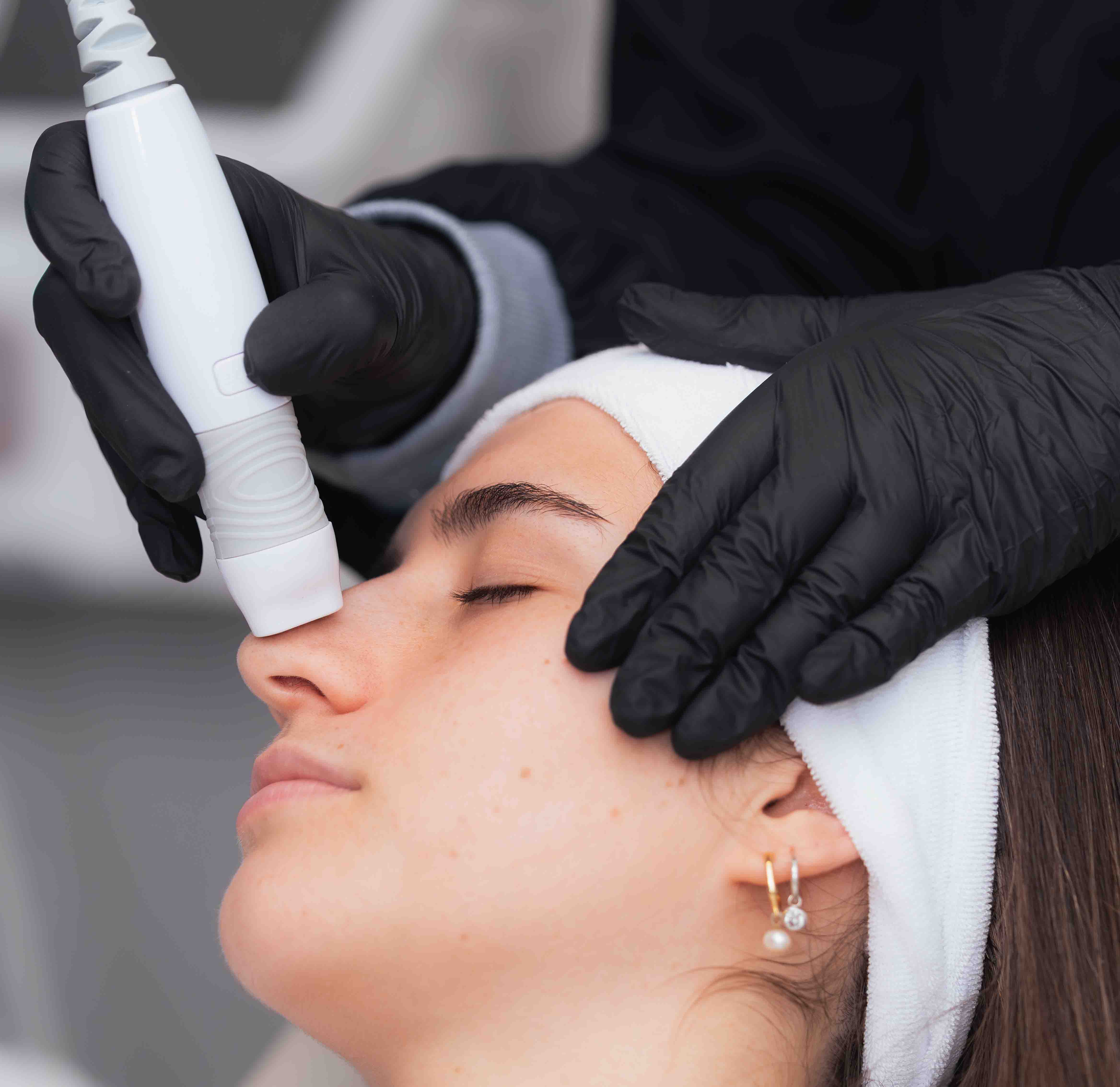 Limpieza facial profunda con hidrafacial