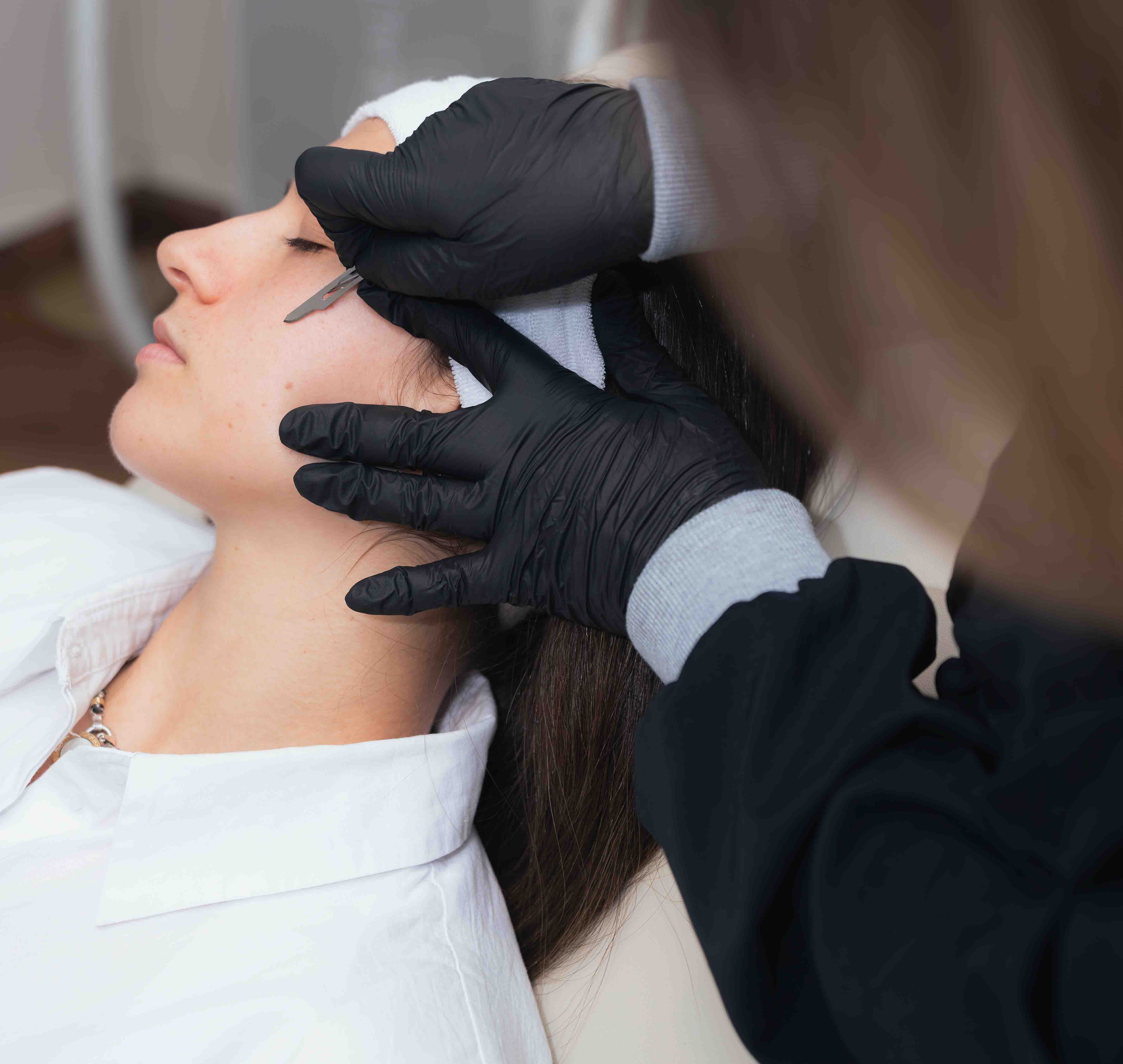 Dermaplaning