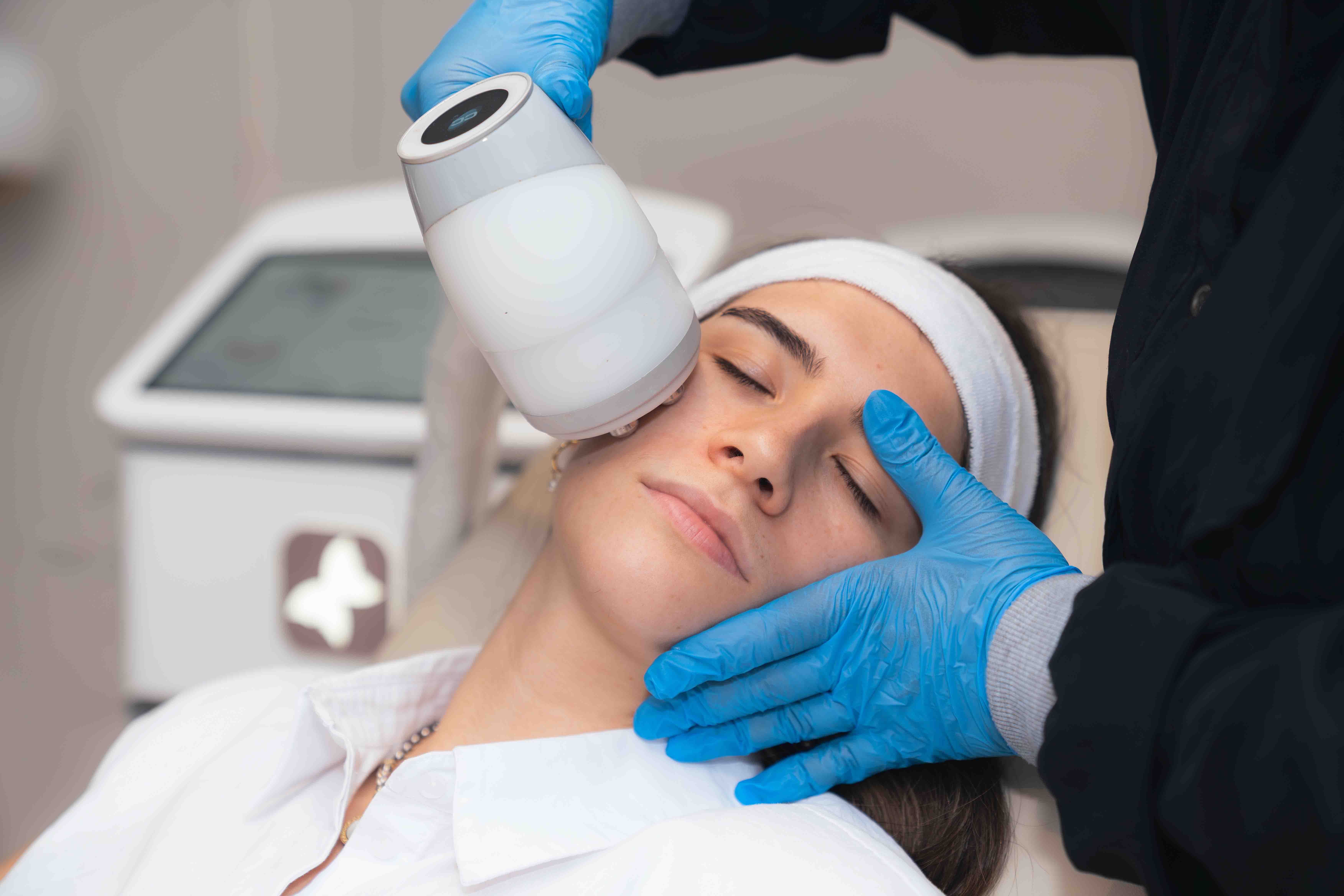 Crioradiofrecuencia facial